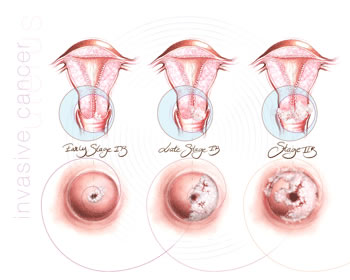 uterus4