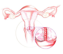 uterus42